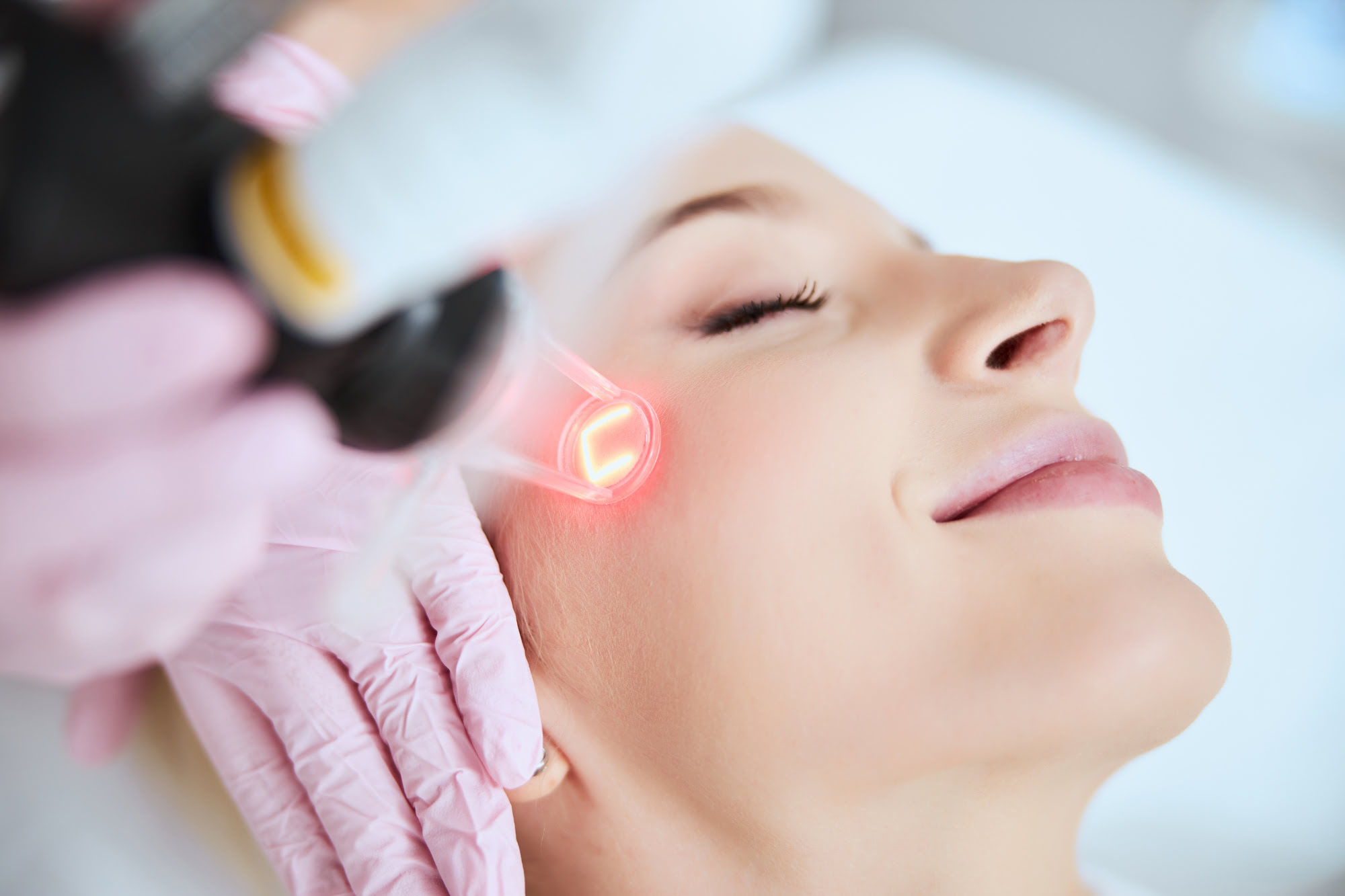 CO2 Laser Resurfacing | Coral Springs Med Spa in Coral Springs, FL