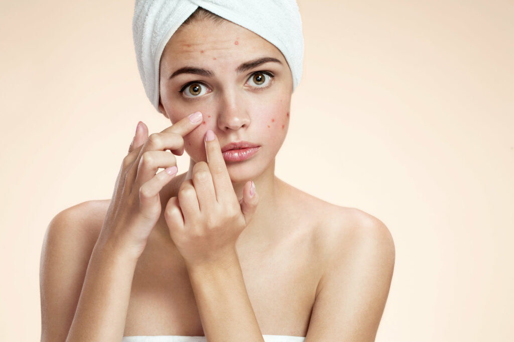 women examines the moles or acne | Coral Springs Med Spa in Coral Springs, FL