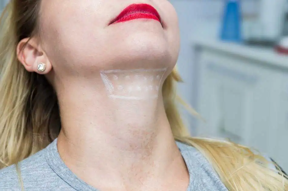 Kybella Treatment in Coral Springs, FL by Coral Springs Med Spa